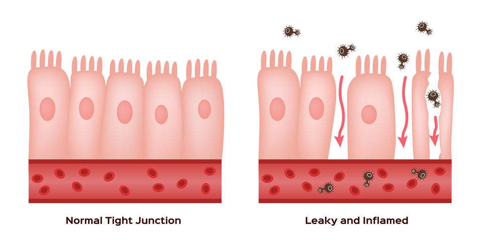 bone broth for leaky gut