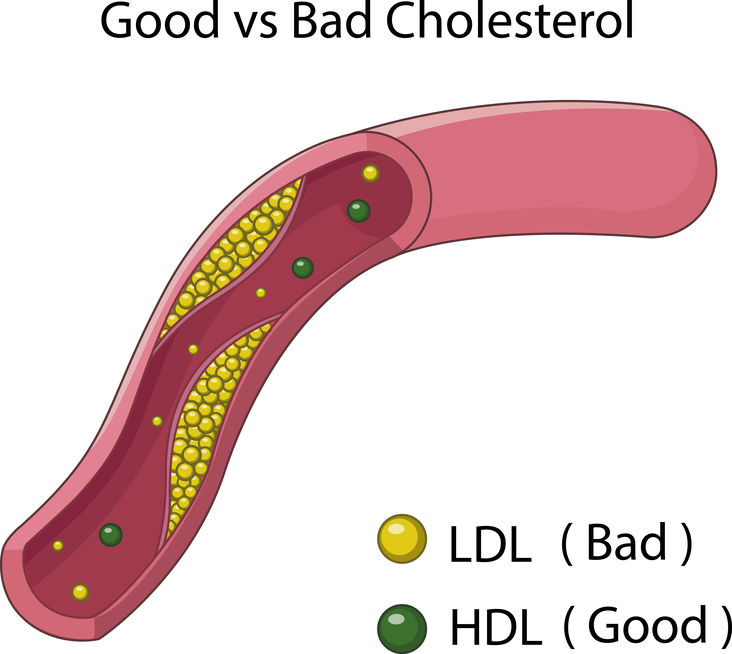 mct oil reduces bad cholesterol